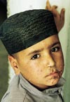 Gutt med impetigo. Alle vanlige &laquo;norske&raquo; barnesykdommer finnes i Afghanistan. Hudsykdommer, diar&eacute;, luftveissykdommer og&hellip;