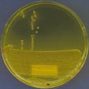 Typiske kolonier med Escherichia coli dyrket p&aring; laktosemedium. E coli er en av bakteriene som blir resistensoverv&aring;ket av&hellip;
