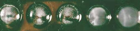 Figur 2  Positiv lateksagglutinasjonstest for p&aring;visning av antigen fra Cryptococcus neoformans. I br&oslash;nnene fra venstre mot&hellip;