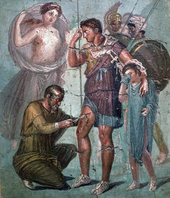 Freske fra Pompeii utstilt i Napolis nasjonalmuseum som viser en episode fra Aeneiden, bok 12. Legen Iapyks fjerner en pil&hellip;