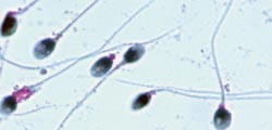 Verdens helseorganisasjon har gitt strenge retningslinjer om testing av s&aelig;d. Foto Andrologisk laboratorium/Rikshospitalet