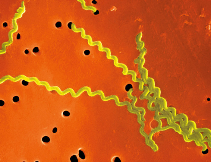 Figur 1  Leptospira interrogans. Elektronmikroskopi. Foto T. Carvalho/Visuals Unlimited/Corbis/Scanpix