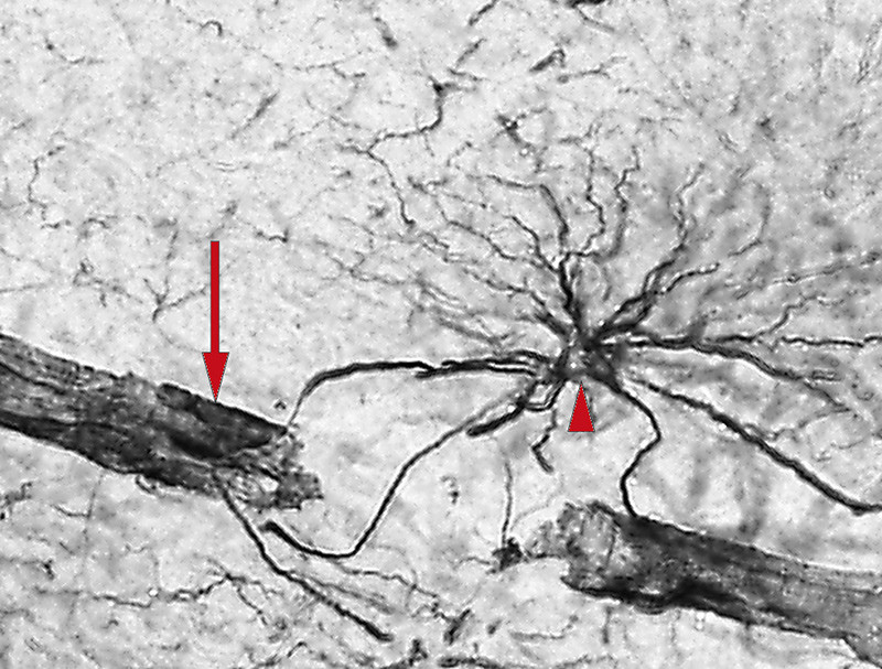 Figur 2  Astrocytt med utl&oslash;pere mot hjerneparenkym og blodkar. Immunhistokjemisk merking av kaliumkanalen Kir4.1 i human&hellip;