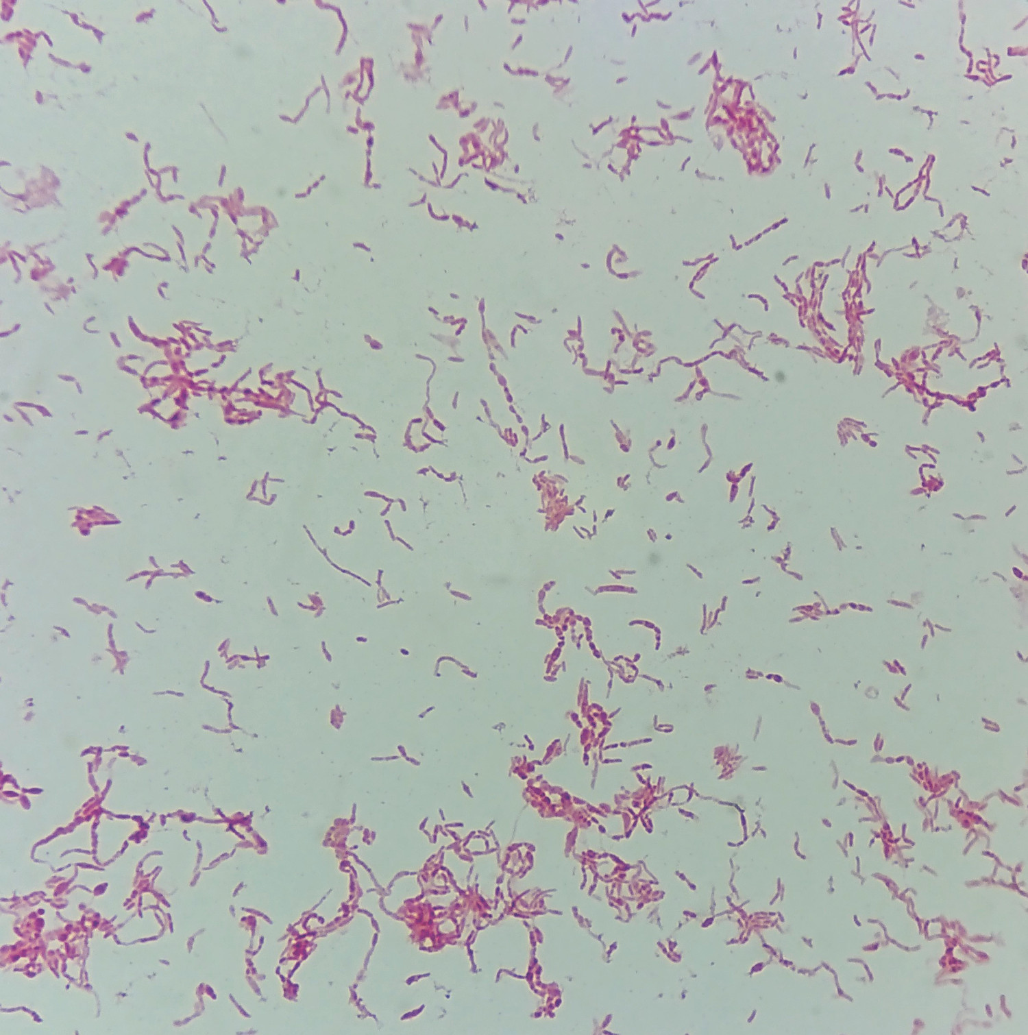 Figur 2 Gramfarget preparat av Streptobacillus moniliformis som illustrerer bakteriens pleomorfe utseende. Legg spesielt&hellip;
