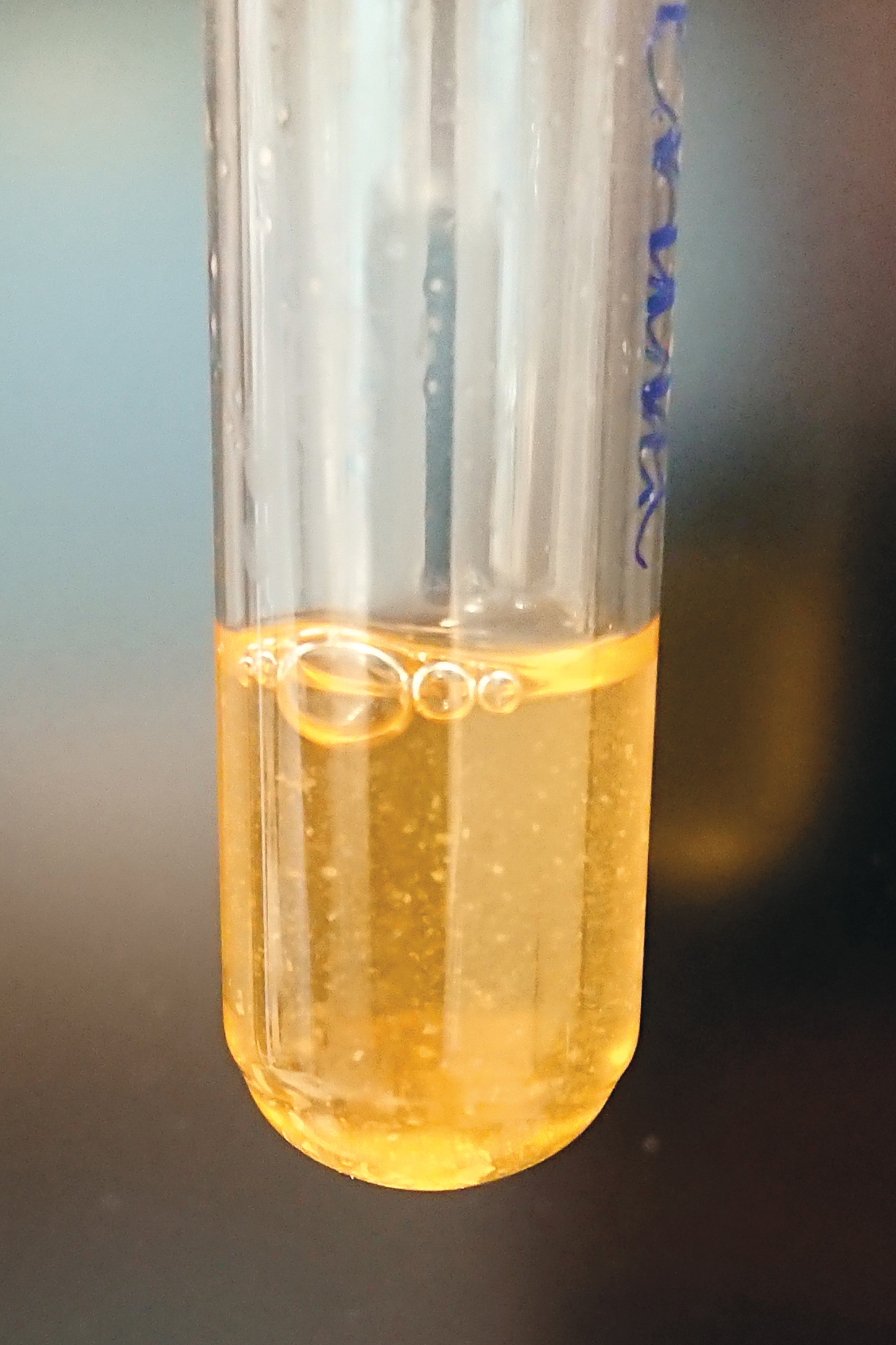 Figur 3 Streptobacillus moniliformis i vekstmediet BHI (brain-heart infusion)-buljong tilsatt 10 % hesteserum. Bildet er&hellip;