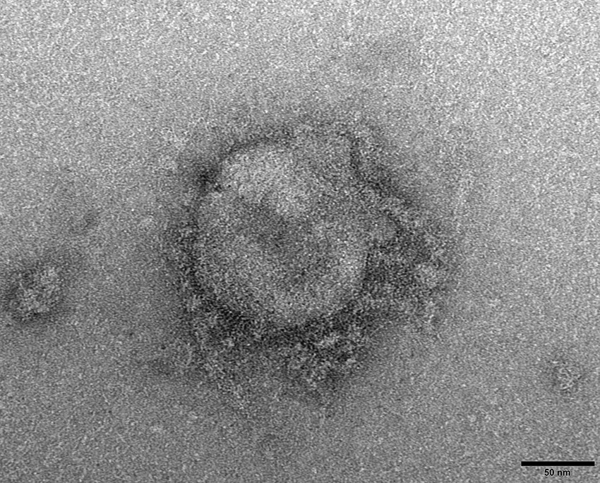 Figur 1 SARS-CoV-2-virus p&aring;vist med transmisjonselektronmikroskopi (180&nbsp;000 &times; forst&oslash;rrelse) i pr&oslash;vemateriale fra indekskasus&hellip;