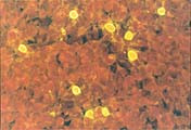  Figur 1    C pneumoniae dyrket i cellekulturer (McCoy-celler). Cellene er fiksert 48 timer etter inokulering. Cellene er&hellip;