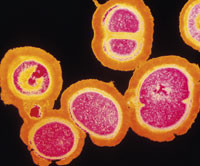 Tykkvegget multiresistent bakterie. Illustrasjonsfoto Sciencephoto/SCANPIX