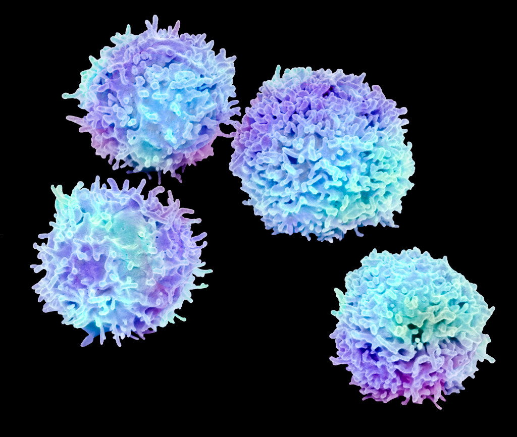 Hvilende T-lymfocytter. Illustrasjonsfoto: Science Photo Library/NTB Scanpix