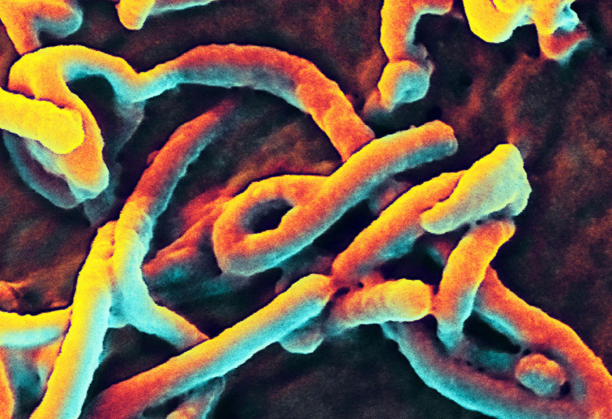 Filovirus er en gruppe virus som omfatter marburgvirus og ebolavirus, og som gir opphav til virale hemoragiske&hellip;