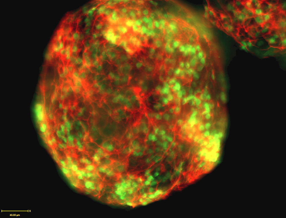CRISPR-Cas9-redigert motonevron, elektronmikroskop. Illustrasjonsfoto: T. Macfarlan, National Institute of Child Health and&hellip;