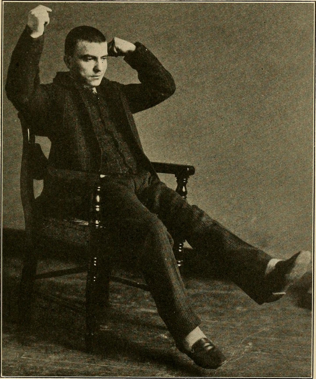 Katatonisk tilstand. Illustrasjosfoto: Diseases of the Nervous System &ndash; A Text-book of Neurology and Psychiatry, 1915. I&hellip;